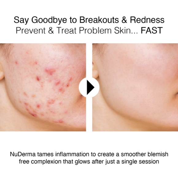 NuDerma Natural Dermal Cell Energy Amplification System - Picture 5 of 5